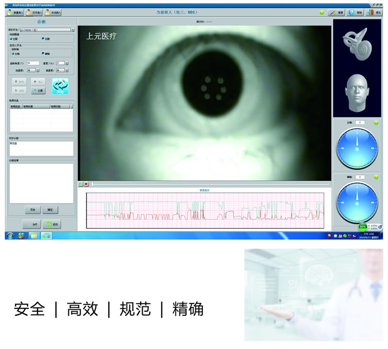 与手法复位比较的优势